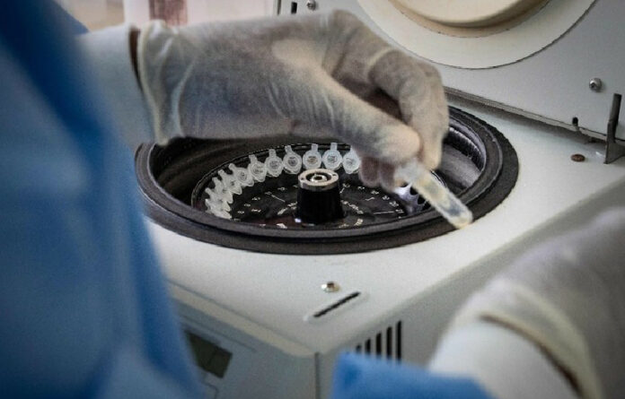 Un técnico de laboratorio procesa muestras para analizar el nuevo coronavirus COVID-19. Foto Afp.